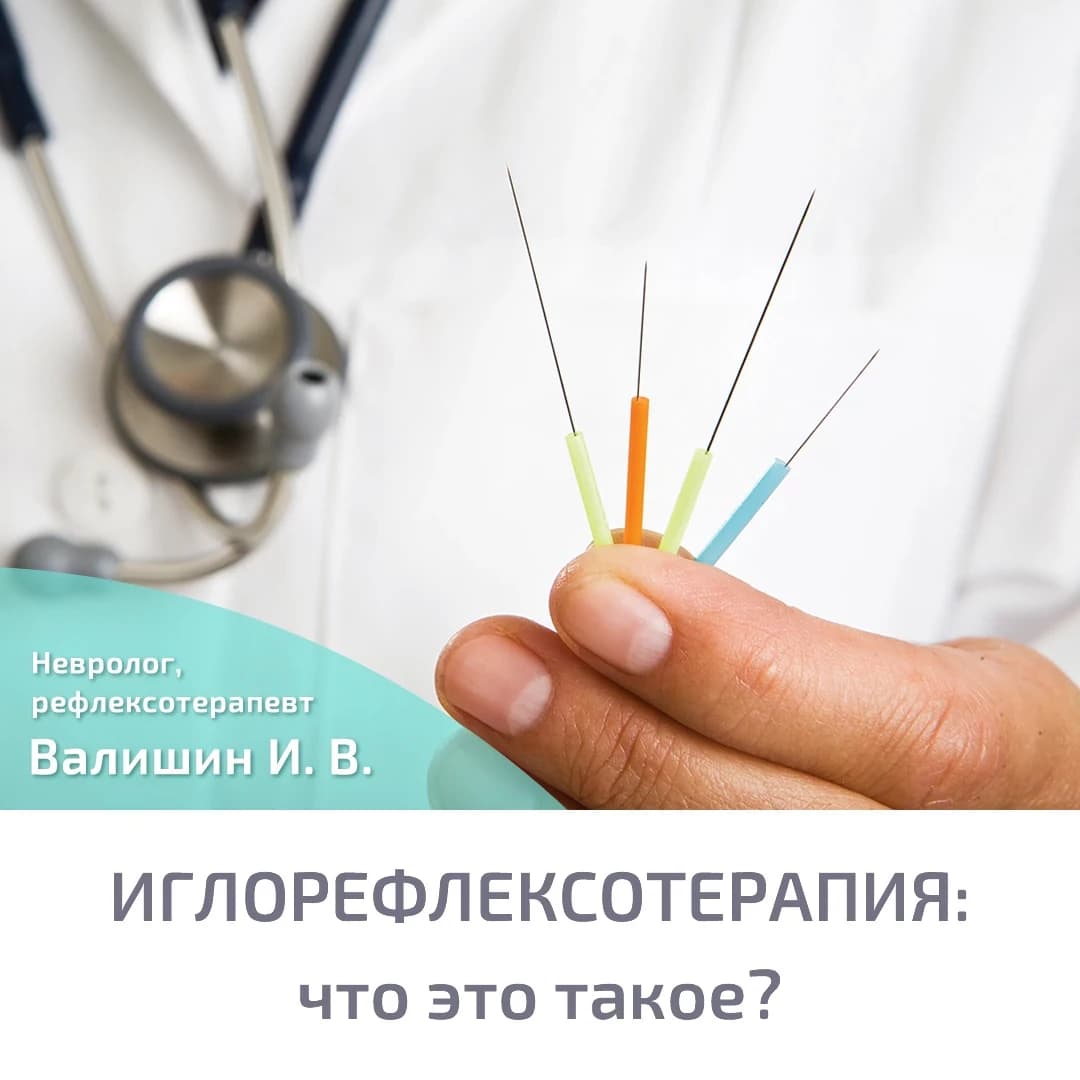 Иглорефлексотерапия: что это такое?