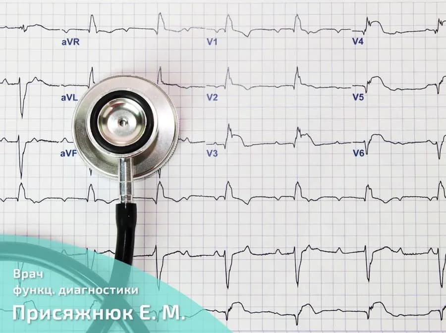 Мне нужно ЭКГ?