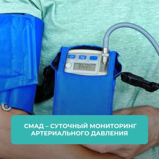 СМАД — суточный мониторинг давления — Клиника доктора Маннанова